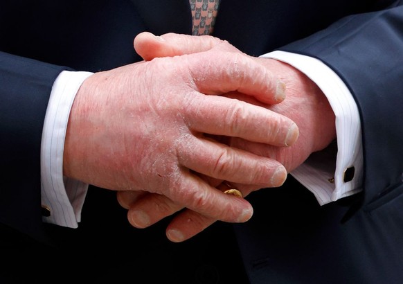 LONDON, UNITED KINGDOM - MARCH 10: (EMBARGOED FOR PUBLICATION IN UK NEWSPAPERS UNTIL 24 HOURS AFTER CREATE DATE AND TIME) King Charles III (hand detail) attends the annual Commonwealth Day Service of  ...