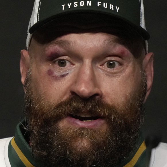 Tyson Fury a réussi son retour sur les rings