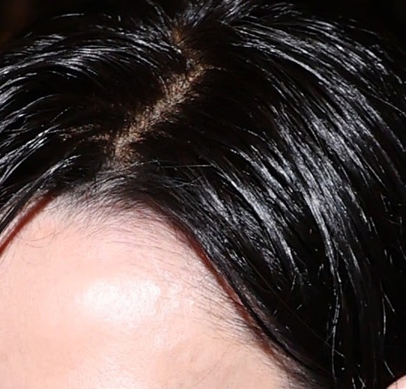 La perruque presque invisible de Demi Moore.