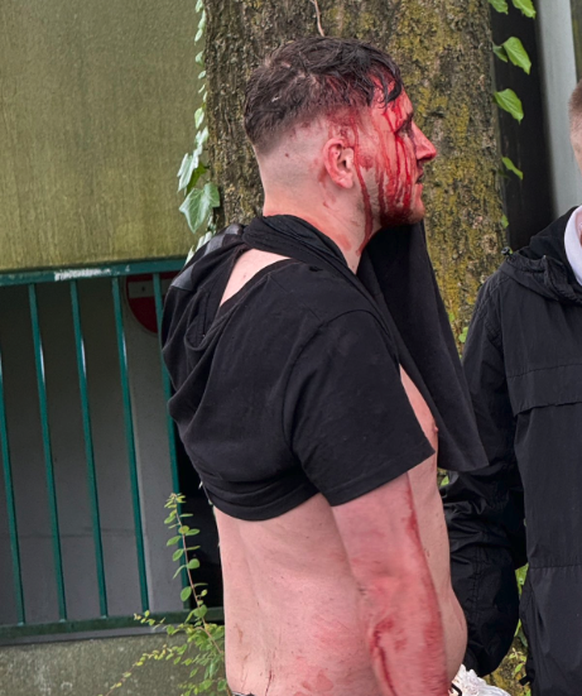 Les violentes bagarres dimanche après-midi à Gelsenkirchen ont laissé des traces.