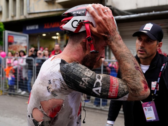 Adam Yates a renoncé à prendre le départ de la 3e étape du Giro