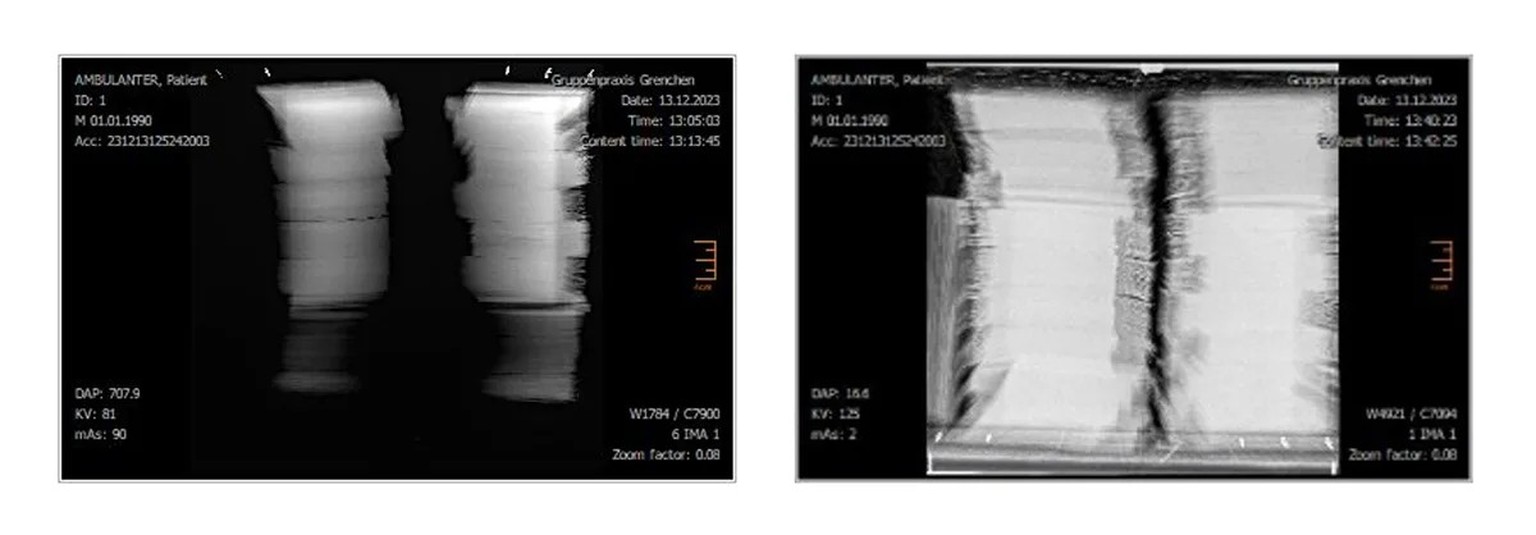Ces radiographies permirent de jeter un œil à l’intérieur du colis.