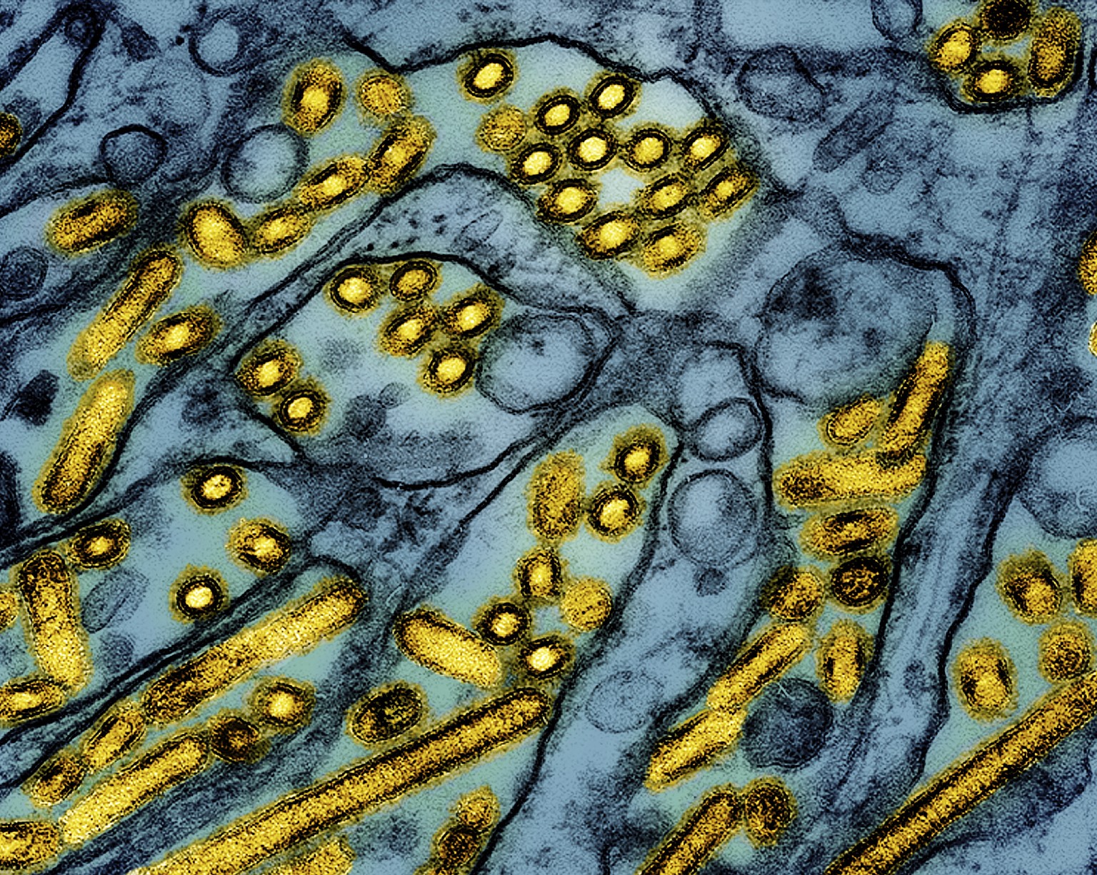 FILE -This colorized electron microscope image released by the National Institute of Allergy and Infectious Diseases on March 26, 2024, shows avian influenza A H5N1 virus particles (yellow), grown in  ...