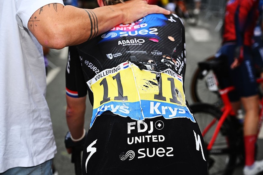 ANGERS, FRANCE - JULY 28: injured detailed view of Demi Vollering of Netherlands and Team FDJ - SUEZ after the 4th Tour de France Femmes 2025, Stage 3 a 163.5km stage from La Gacilly to Angers / #UCIW ...
