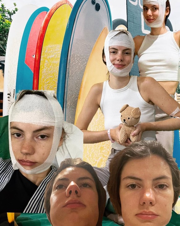 La candidate s'appelle Pimprenelle. Dans un post Instagram, elle fait référence à une double fracture de la mâchoire et affiche son visage couvert de pansements après une lourde opération.