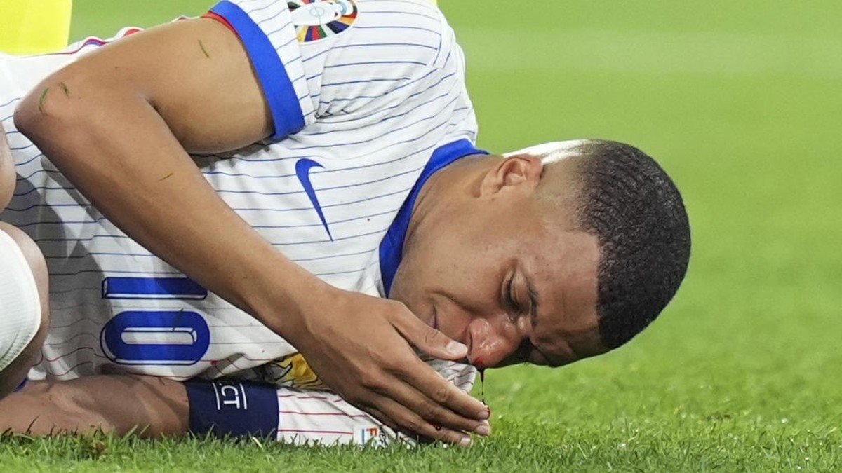 Nez cassé de Kylian Mbappé: «Ça va le faire, pas d'opération»