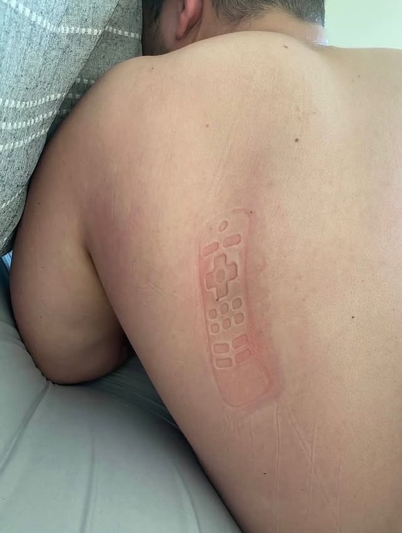 Die lustigsten Fails der Woche: Mittagsschlaf Abdrücke