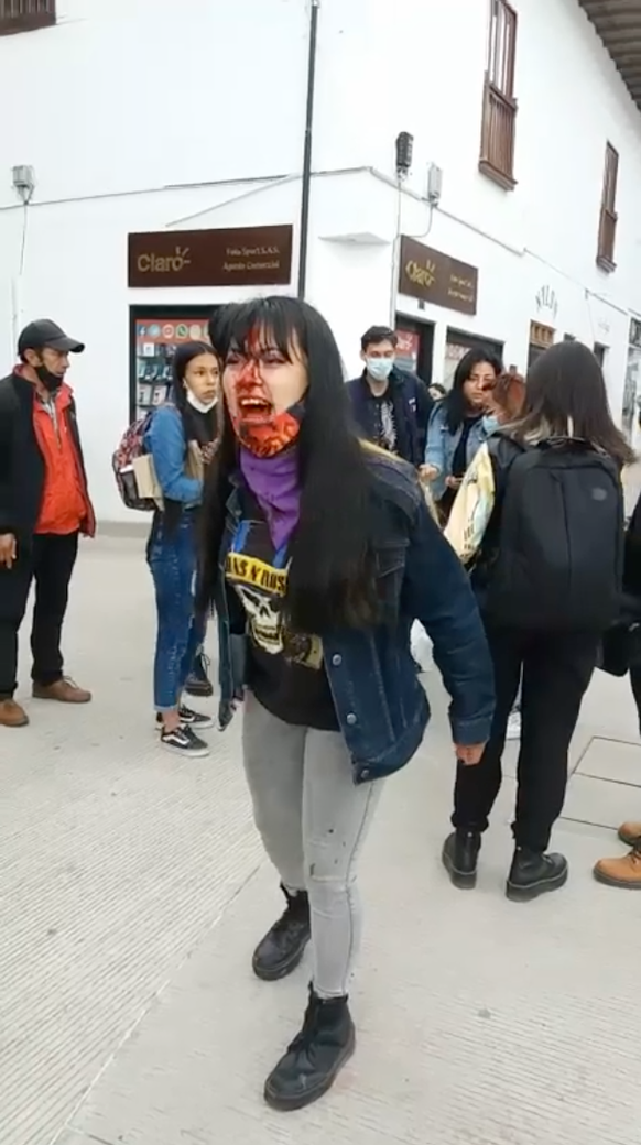 Cette étudiante de 20 ans a reçu des coups de matraque sur la tête, mais aussi dans les jambes. Elle a eu besoin d'un soutien respiratoire pendant plusieurs heures et a été incapable de travailler pen ...