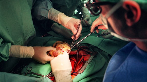 Le cœur du donneur est implanté dans la cage thoracique d'un patient à l'Hôpital de l'Île à Berne. 
