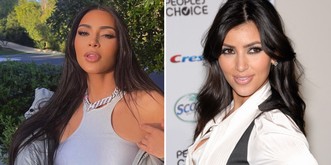 «Jamais de filler» - Kim K révèle ses opérations de chirurgie esthétique