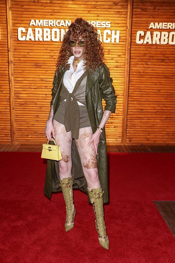 MIAMI, FLORIDA - MAY 02: Winnie Harlow attends Amex x CARBONE BEACH 2026 in Miami Beach, FL on May 02, 2026 in Miami, Florida. (Photo by John Parra/Getty Images for Amex x Carbone Beach)