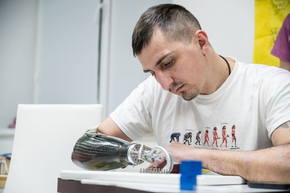 LVIV, UKRAINE - JANUARY 28: A Ukrainian veteran performs fine motor skills exercises with his prosthetic arm at the Lviv Regional Hospital, where Ukrainian military personnel undergoing treatment and  ...