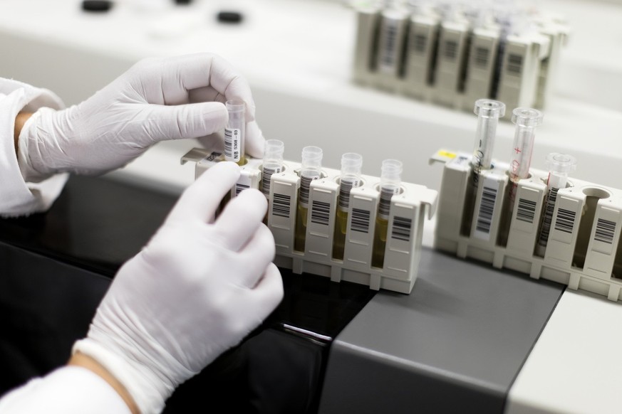 L&#039;OFSP a recensé en 2023 352 nouveaux cas d&#039;infection au virus du sida (HIV), soit une baisse par rapport aux deux années précédentes. Le taux d&#039;incidence se monte à 4 cas pour 100 000  ...