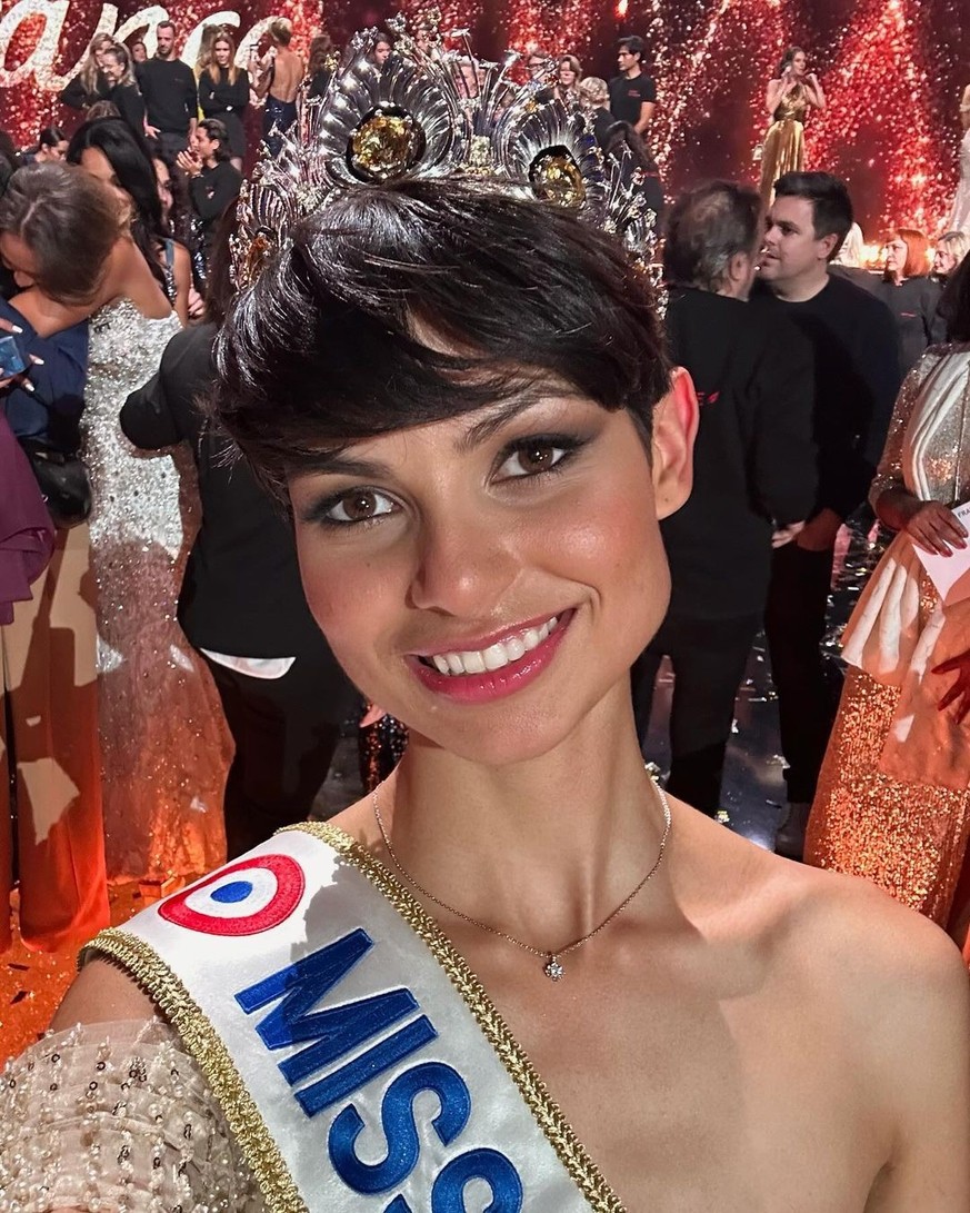 Les cheveux courts de Miss France 2024, Eve Gilles, ont suscité de vives critiques sur les réseaux sociaux.