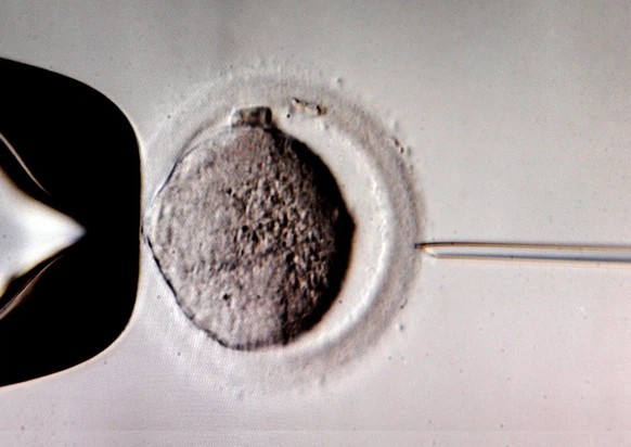 Les couples hétérosexuels ont accès au don de sperme en Suisse depuis 20 ans.