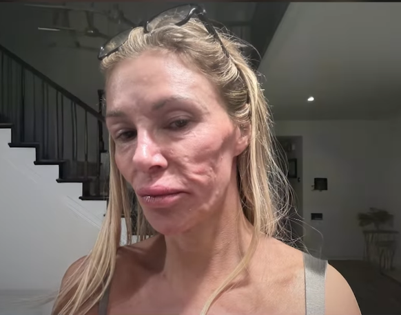 Brandi Glanville est méconnaissable