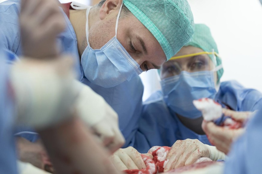 A patient with burns is being treated during a surgical intervention, photographed at the intensive care unit of the University Hospital of Zurich, Switzerland, on January 17, 2017. (KEYSTONE/Gaetan B ...