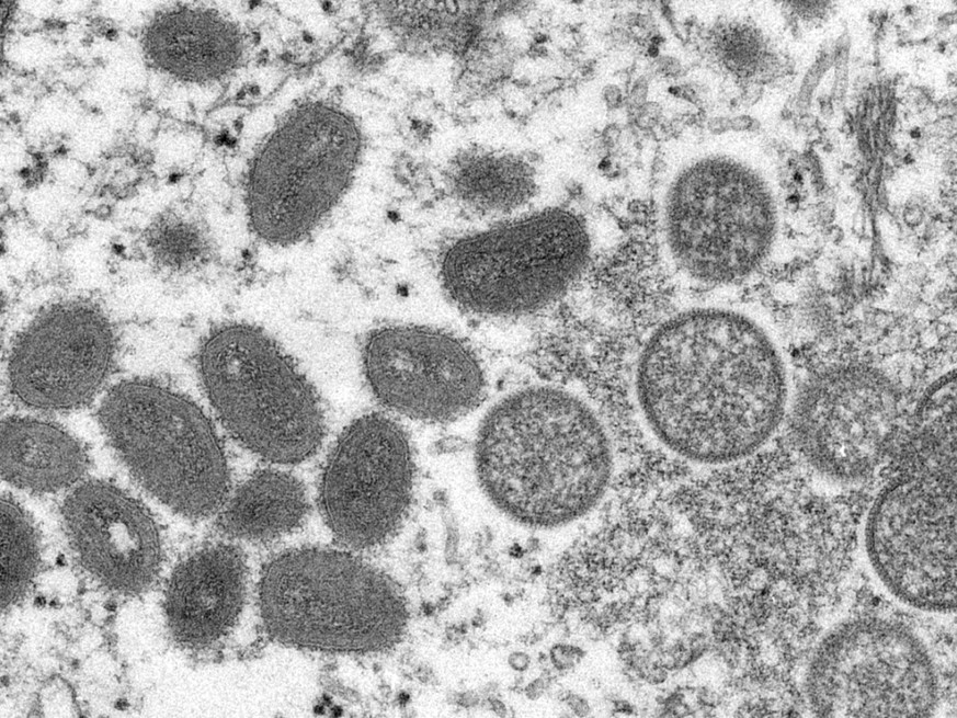 La variole du singe ou &quot;orthopoxvirose simienne&quot; est une maladie rare dont le pathog
