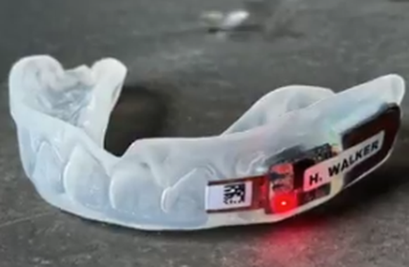 Le protège-dents connecté affiche une lumière rouge en cas de choc violent à la tête.