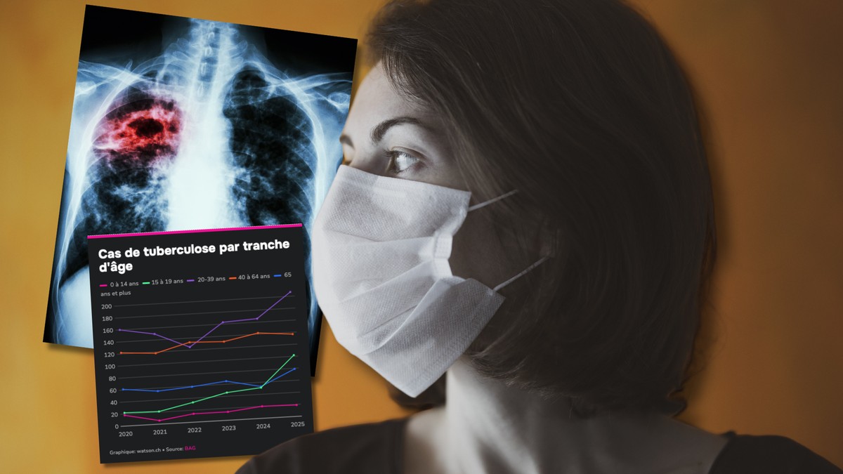 Cette vieille maladie mortelle explose chez les ados en Suisse 