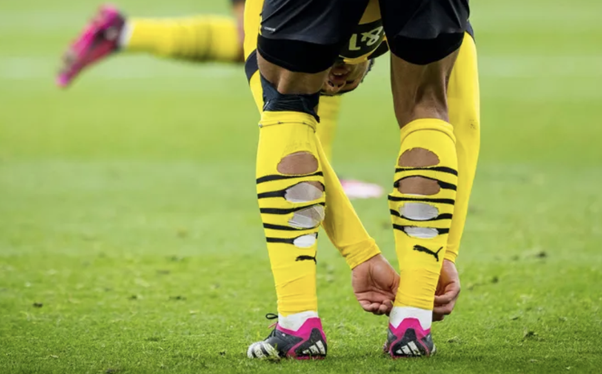 Pourquoi les footballeurs font-ils des trous à leurs chaussettes?