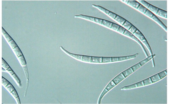 Des spores de Fusarium equiseti, l&#039;un des champignons responsables du développement des mycotoxines.