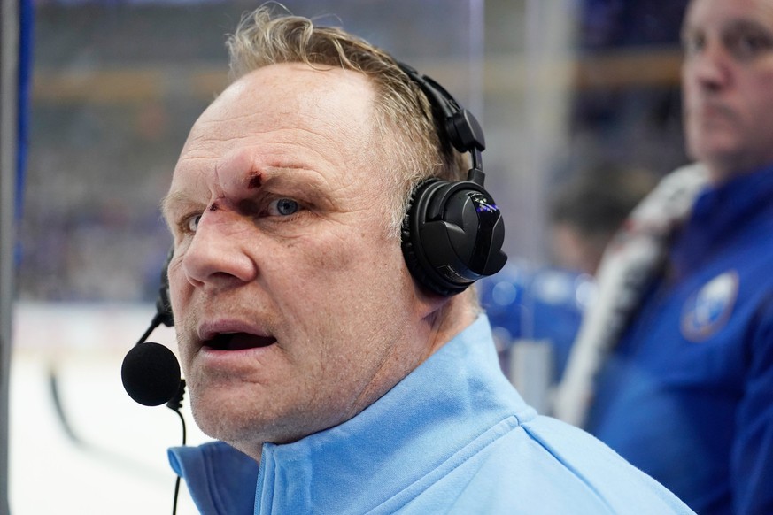 Rob Ray amoché, après l'incident.