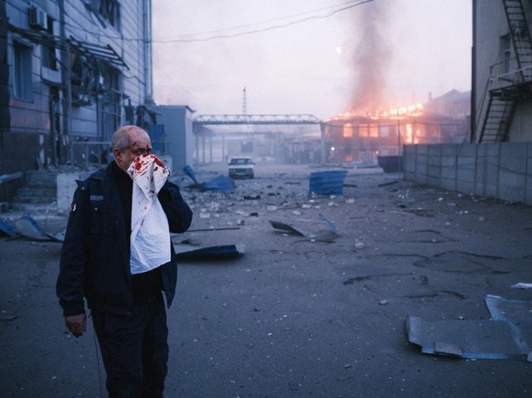 KHARKIV, UKRAINE - APRIL 18: (EDITOR&#039;S NOTE: Image depicts graphic content) A wounded man is seen after Russian shelling of a civilian light industry production facility producing creams and perf ...