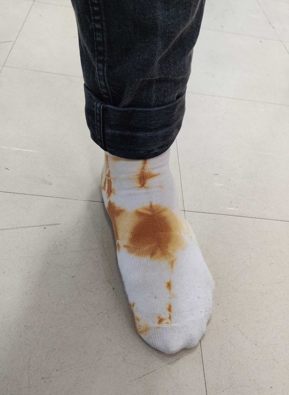 Mode-Fails. Fashion die sich hoffentlich nicht durchsetzt