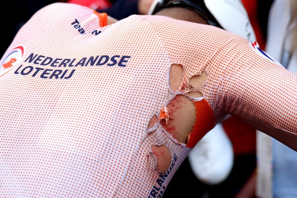 epa10787798 The damaged shrt of Mathieu van der Poel of the Netherlands who crashed on his say winning the Men&#039;s Elite Road Race at the UCI Cycling World Championships 2023 in Glasgow, Britain, 0 ...