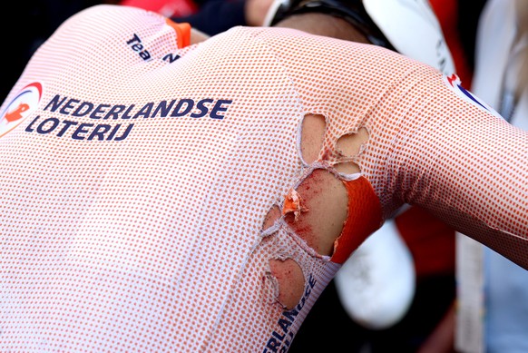 La déchirure de Mathieu van der Poel.