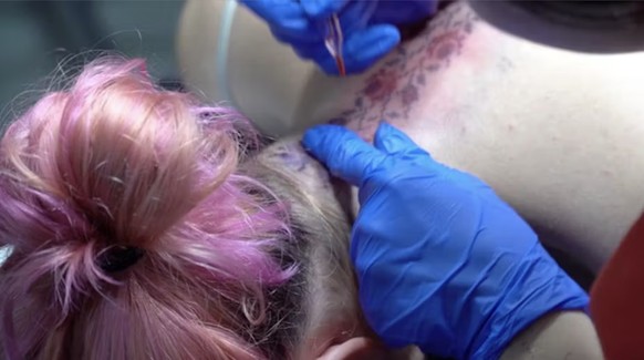 Marguerita, une Ukrainienne vivant au Portugal, se fait tatouer un motif traditionnel sur la nuque.