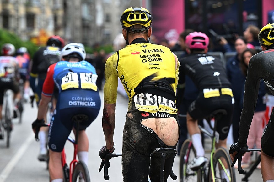 VELIKO TARNOVO, BULGARIA - MAY 09: (EDITOR’S NOTE: Image contains partial nudity.) Wilco Kelderman of Netherlands and Team Visma | Lease a Bike injured after the 109th Giro d'Italia 2026, Stage 2 ...