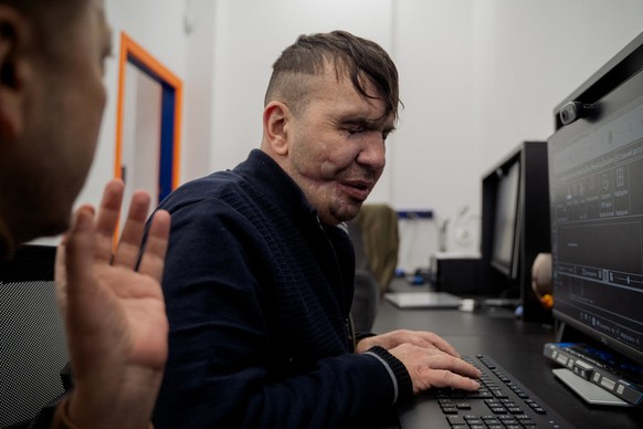 L&#039;ancien soldat Mykola Kazyuk utilise un ordinateur à Trinity Hub, un centre de réhabilitation pour les malvoyants à Kiev, le 7 février 2025.