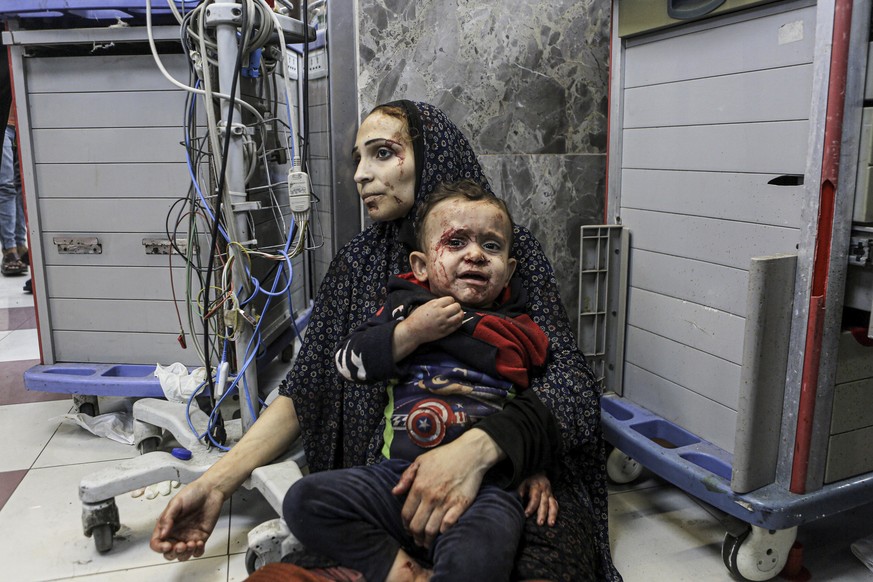 Wounded Palestinians wait for treatment in al-Shifa hospital in Gaza City, central Gaza Strip, after arriving from al-Ahli hospital following an explosion there, Tuesday, Oct. 17, 2023. The Hamas-run  ...