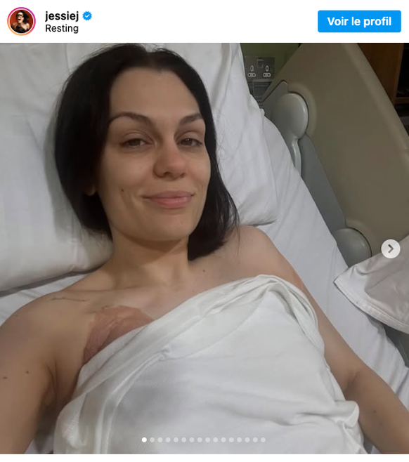 Jessie J, opérée d&#039;un cancer du sein, se confie sur instagram