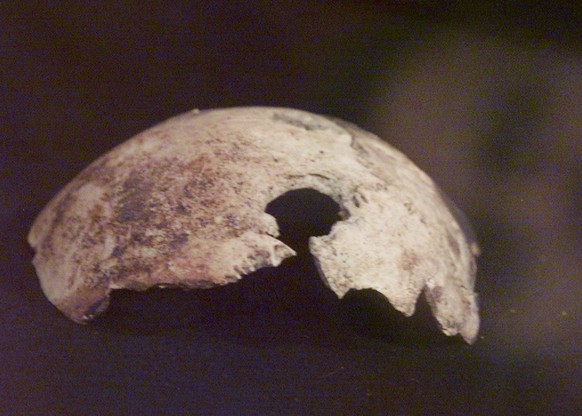 A general view of what Russian officials claim to be a fragment of Adolf Hitler&#039;s skull, at an exhibition in Moscow, Wednesday, April 26, 2000. The scull&#039;s fragment is displayed at the Feder ...