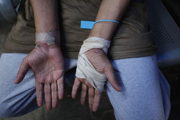 Les traces de la détention sur les mains d&#039;un prisonnier palestinien.