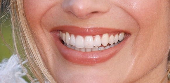 Margot Robbie poses for photographers at the photo call for the film "Wuthering Heights" in London, Wednesday, Feb. 4, 2026. (Photo by Millie Turner/Invision/AP)
Margot Robbie