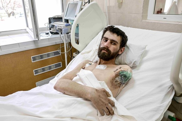 Un soldat amputé du bras gauche dans le service de soins intensifs polytraumatologiques de l'hôpital Mechnykov de Dnipro, en Ukraine, le 14 mars 2025.