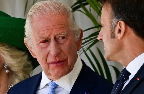 WINDSOR, ENGLAND - JULY 8: French President Emmanuel Macron speaks to King Charles III, whose eye is red, during a welcome ceremony at Windsor Castle as part of Macron&#039;s state visit to the United ...