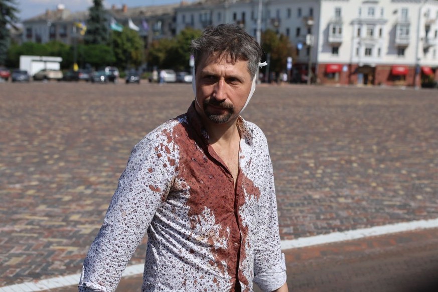 CHERNIHIV, UKRAINE - AUGUST 19: (EDITORS NOTE: Image contains graphic content) A wounded man in a bloody shirt walks across a square in front of the theater building damaged by Russian shelling, where ...