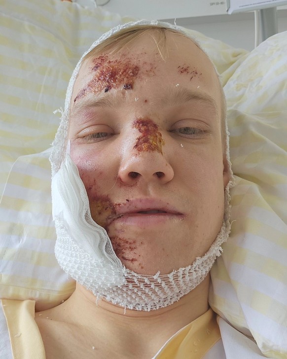 Sondre Ringen à l&#039;hôpital en Suisse