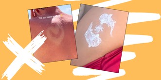 La tendance de l'été? Tout faire pour choper le cancer
