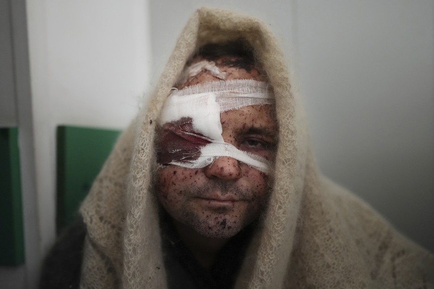Serhiy Kralya, 41, looks at the camera after surgery at a hospital in Mariupol, eastern Ukraine on Friday, March 11, 2022. Kralya was injured during shelling by Russian forces. (AP Photo/Evgeniy Malol ...