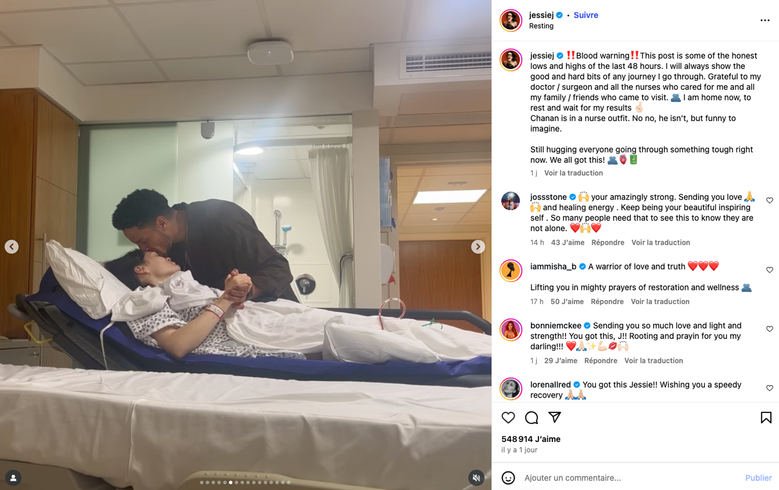 Jessie J, opérée d&#039;un cancer du sein, se confie sur instagram