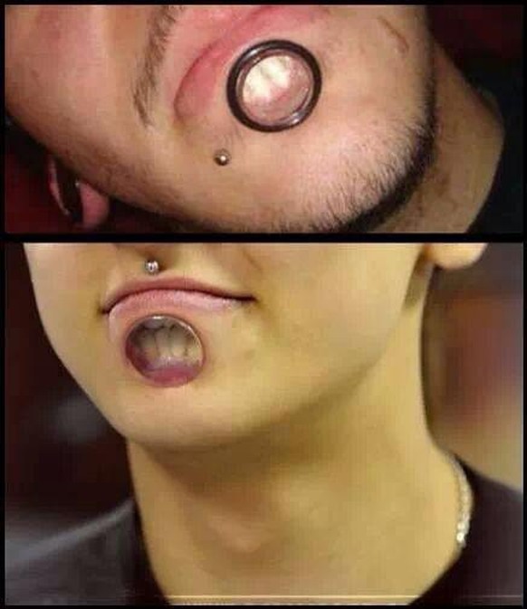 body modification