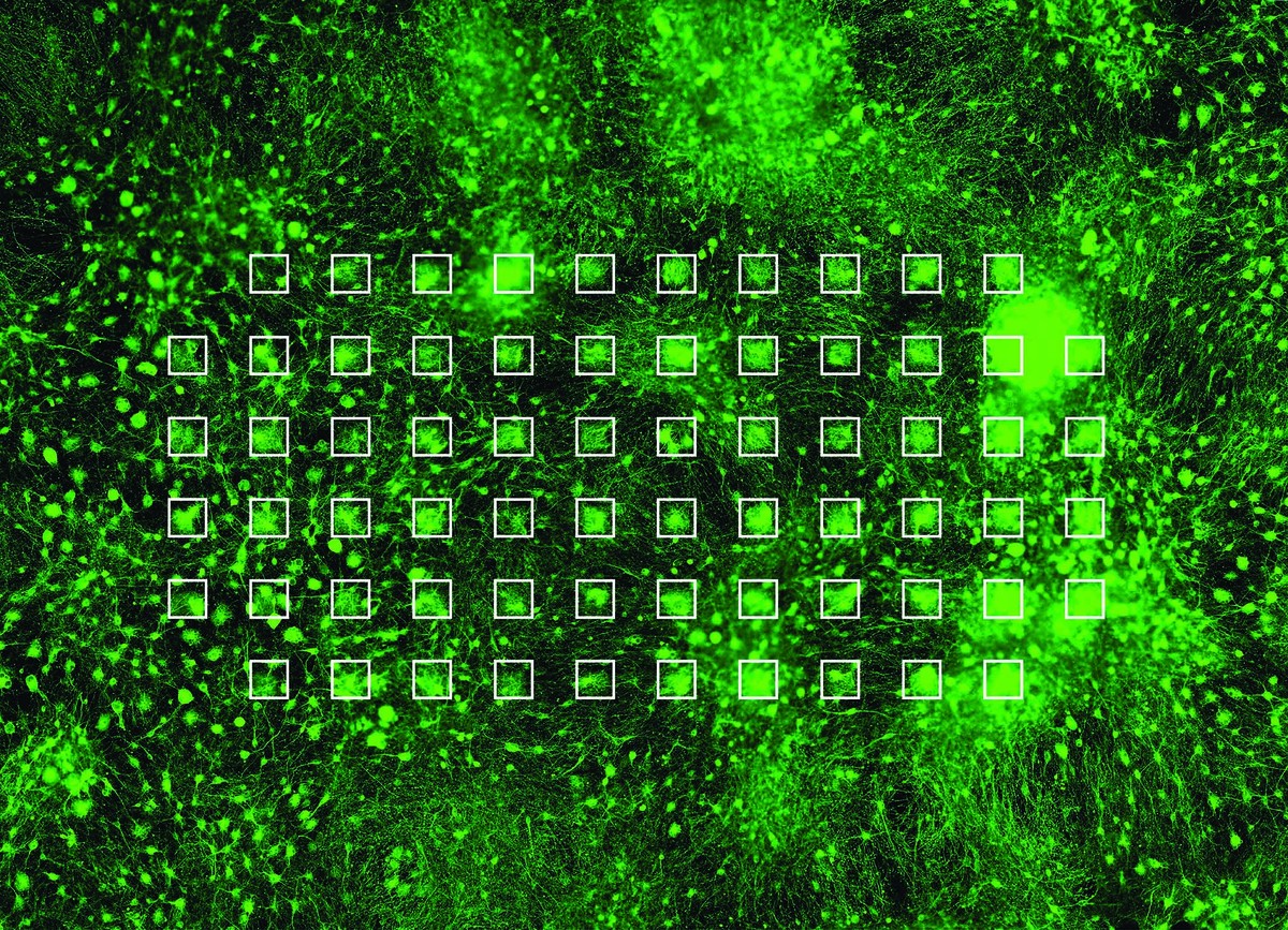 Neuronen, die auf einem MEA gewachsen sind und ein Netzwerk gebildet haben (grün). Die einzelnen Elektroden der MEA sind mit weissen Quadraten hervorgehoben. © Stephen Jenkinson, Institut für Infektio ...