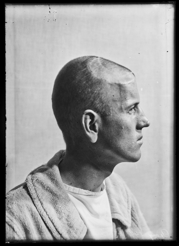 Dr. Crushing Brain Surgery

Yale University Library