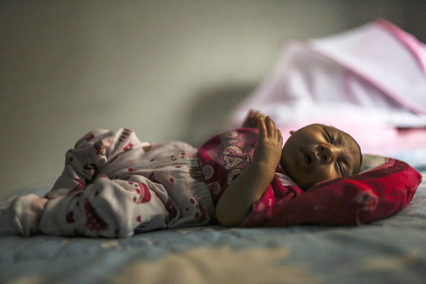 Die kleine Manuelly wurde mit einem missgebildeten Schädel geboren. Ihre Mutter hatte sich während der Schwangerschaft mit dem Zika-Virus infiziert.&nbsp;